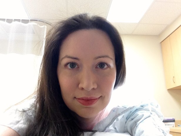 Before Skin Cancer Surgery